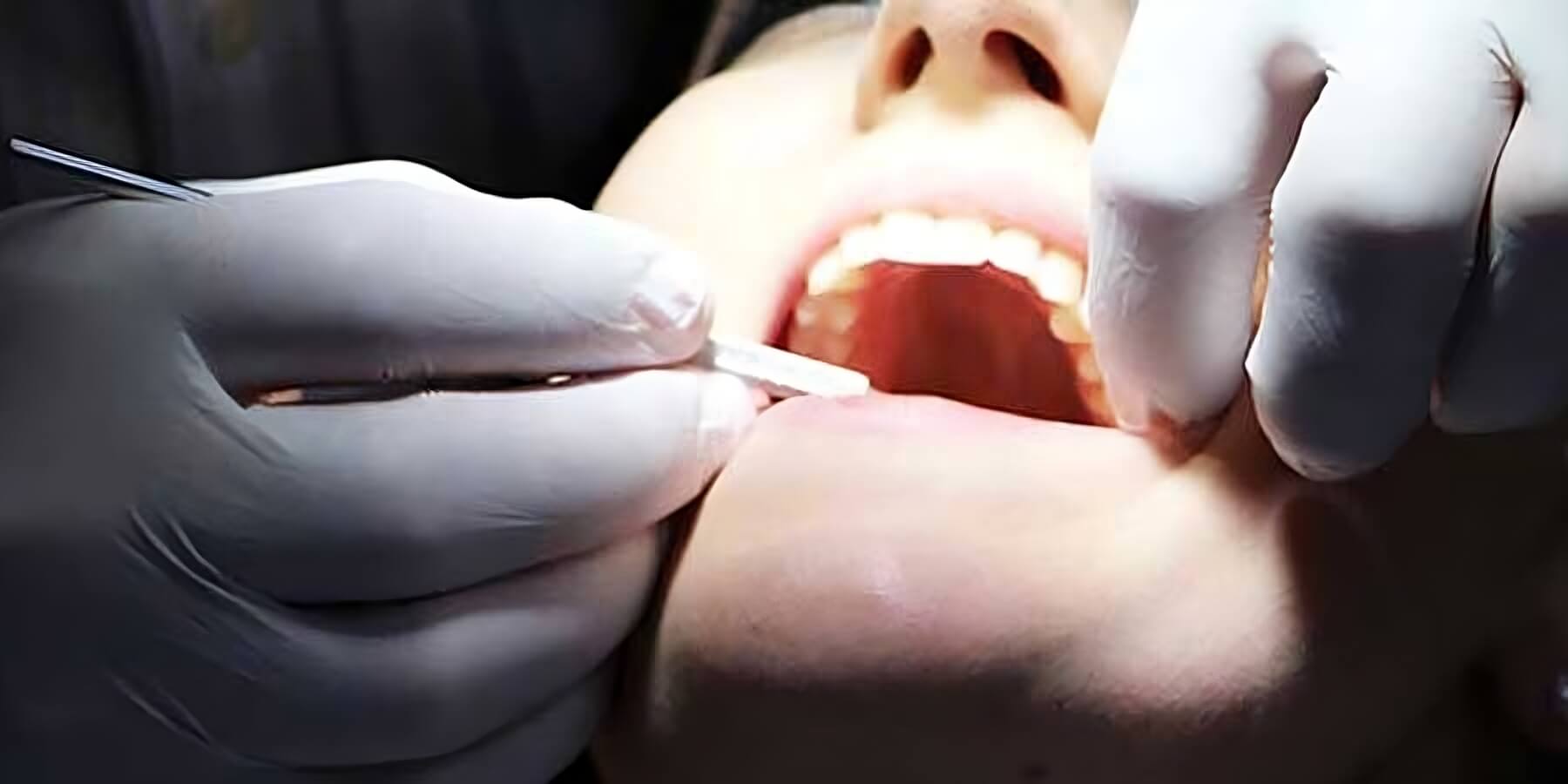 Is-Sedation-Dentistry-for-Me-900x450-transformed