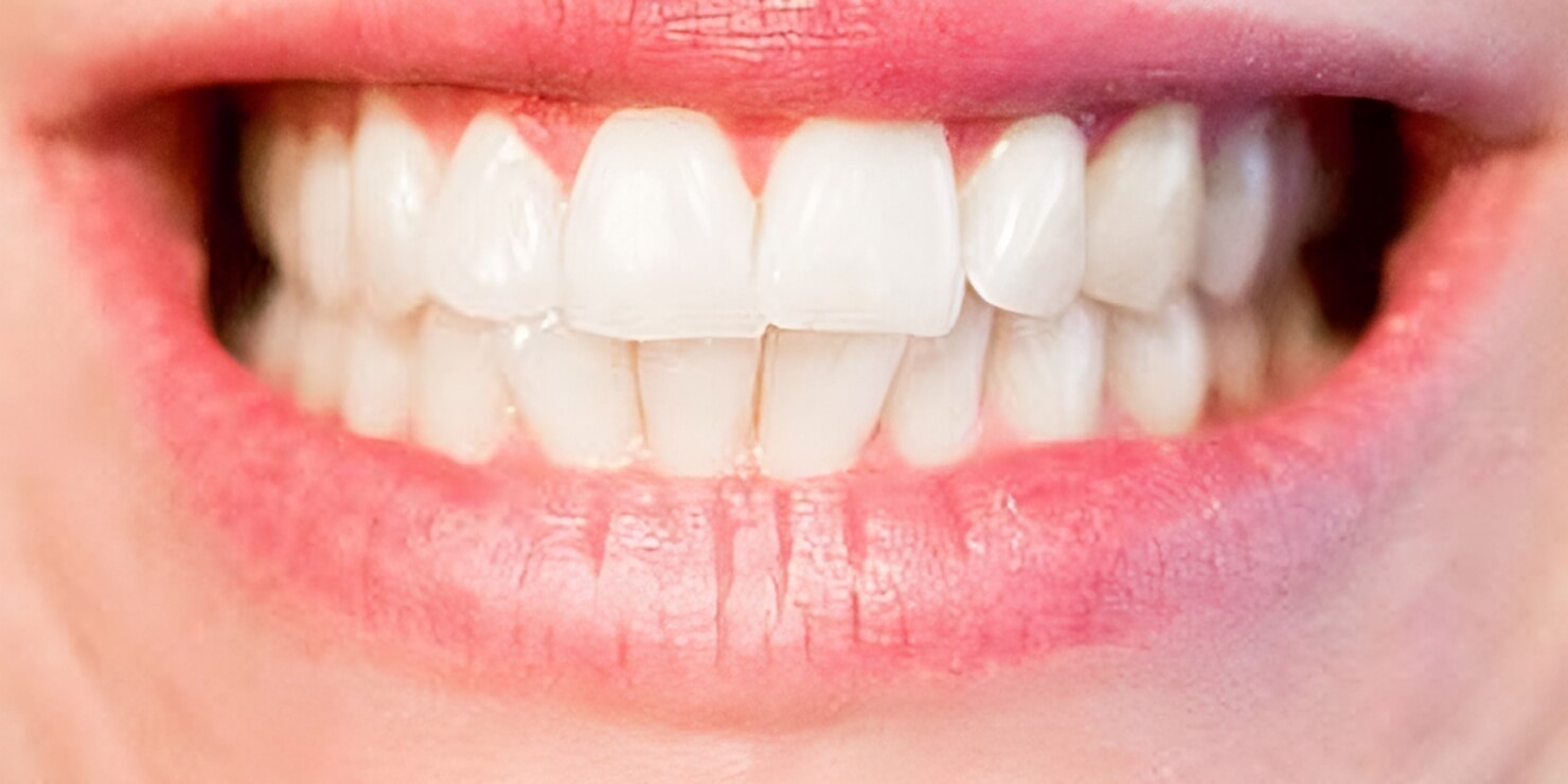 teeth-transformed