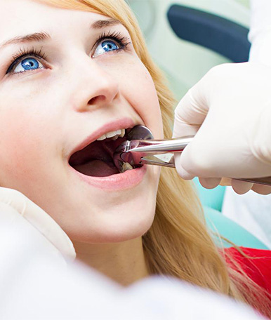 oral-surgery-Wisdom teeth