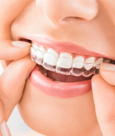 orthodontics-Advanced technology orthodontics