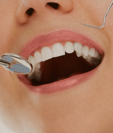 FACIAL TRAUMA card