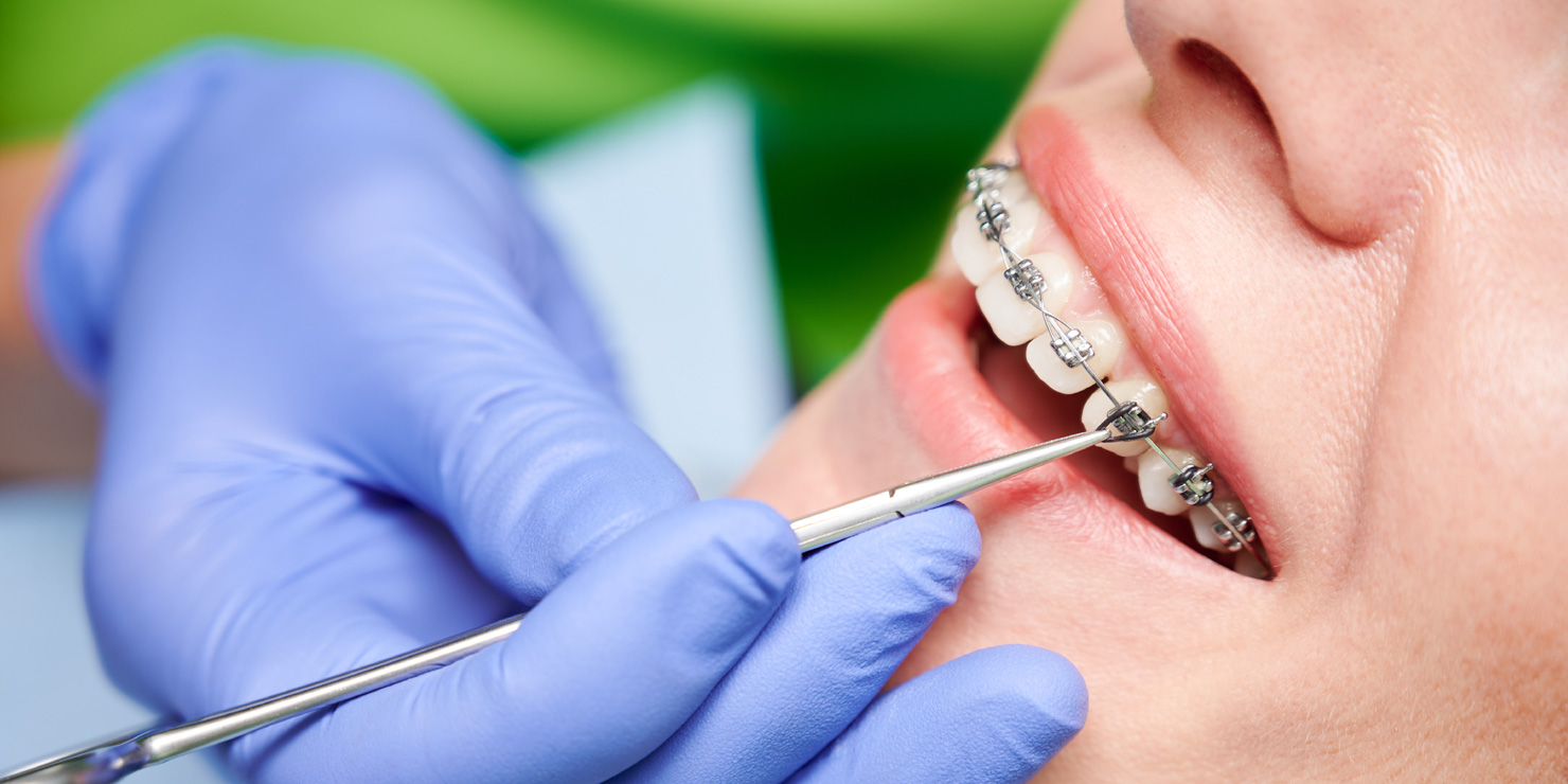 orthodontic-treatment