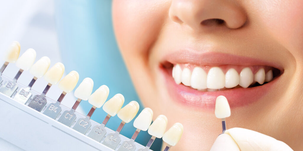 Teeth whitening in a dental clinic