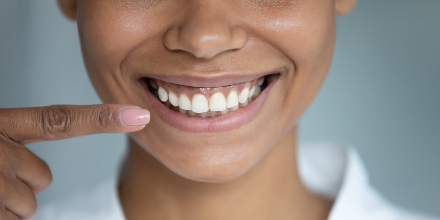White toothy smile