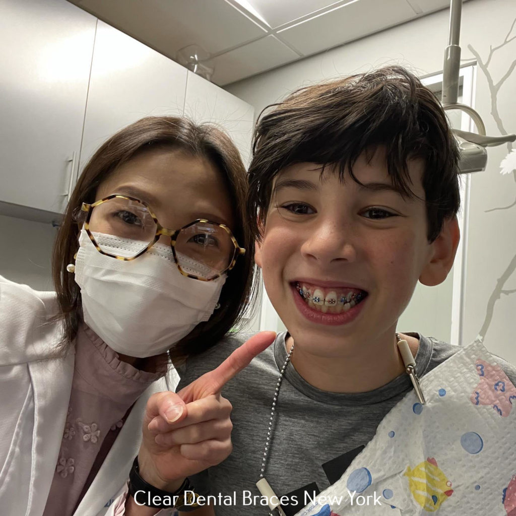 Clear_Dental_Braces_New_York