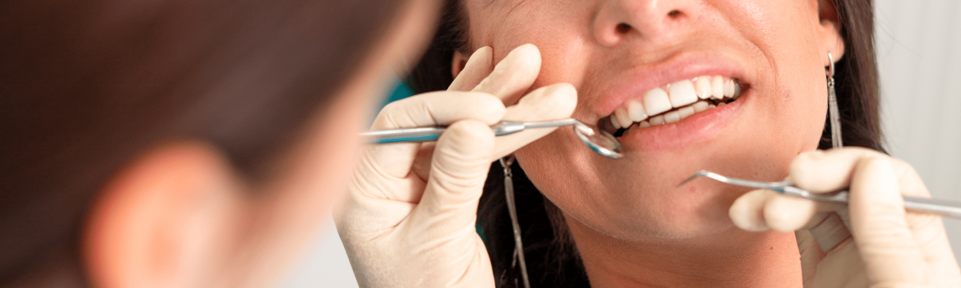 Cosmetic periodontal procedures service