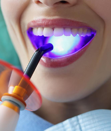 Oral surgery Laser Surgery