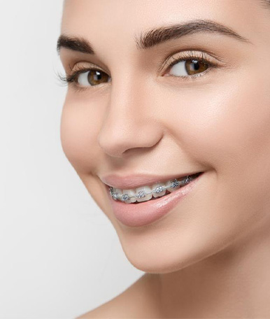 periodontics-Connective-tissue-graft