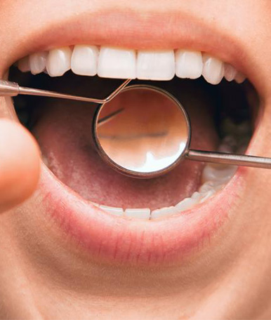 Periodontics-Periodontal-disease-and-prevention