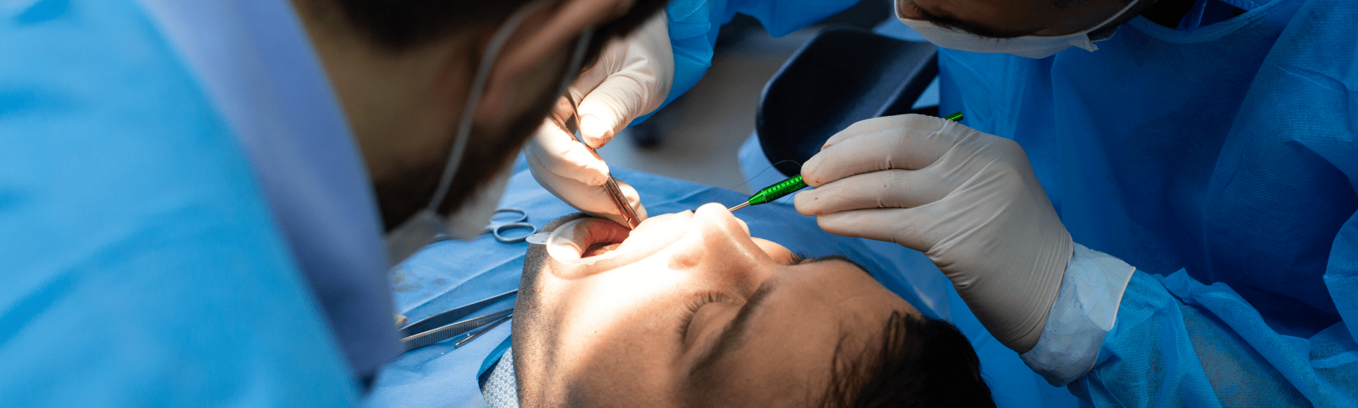 Tooth extractions service