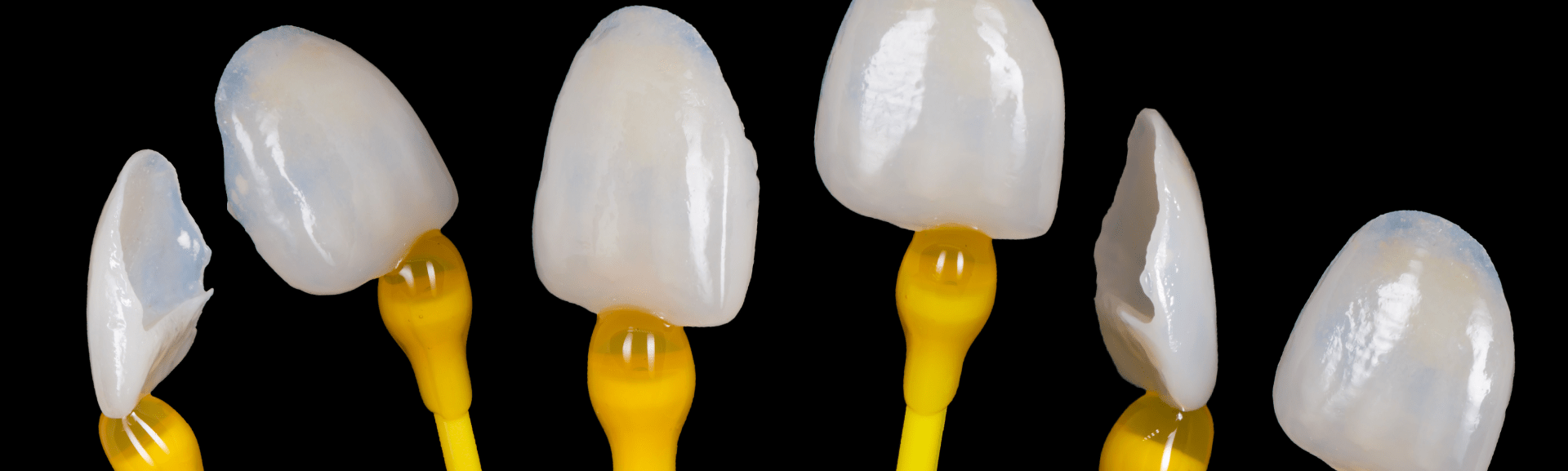 veneers-banner