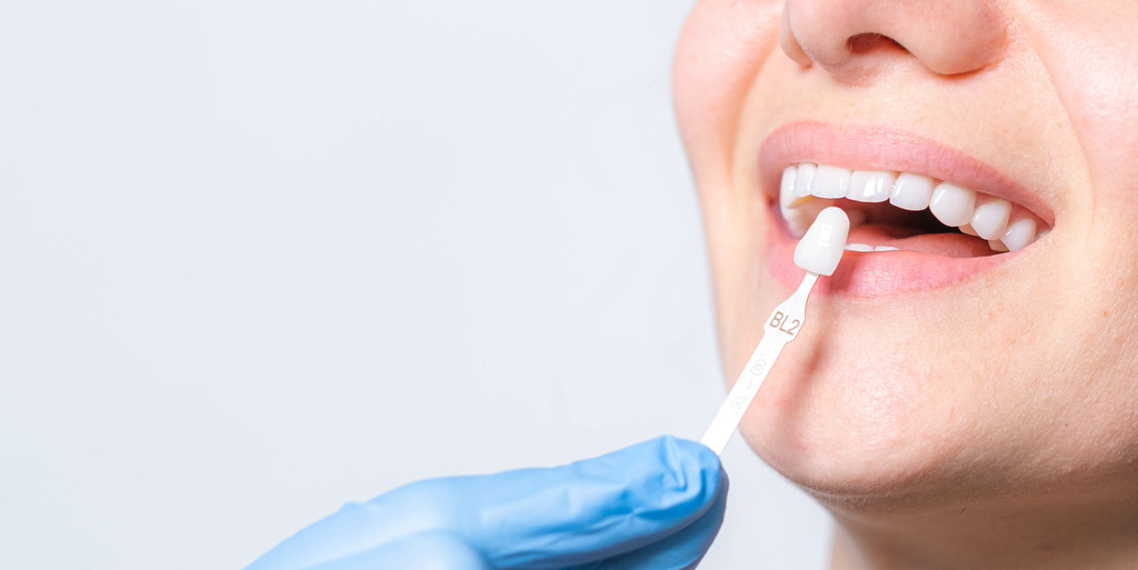 Banner tooth whitening, perfect white teeth close up with shade guide bleach color, female veneer smile, dental care and stomatology, dentistry, copyspace.