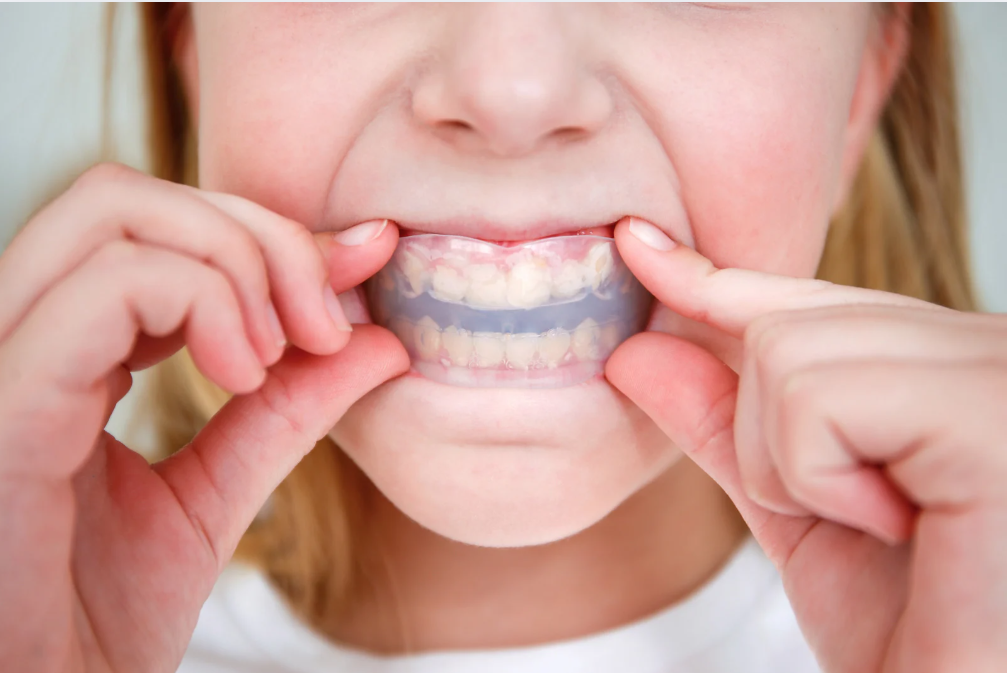 Bite Alignment in Woodmere