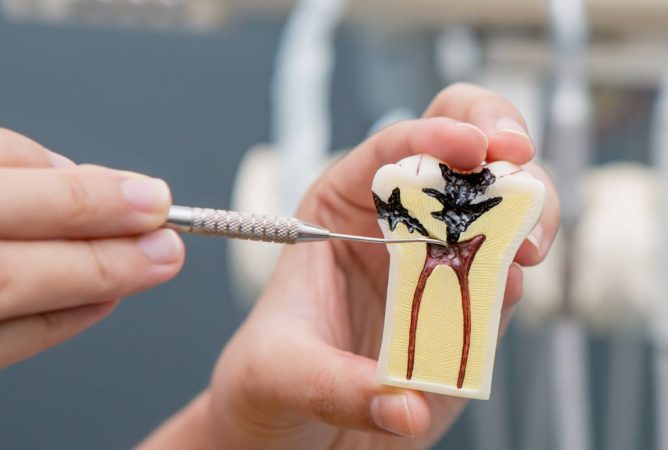 endodontist showing a root canal